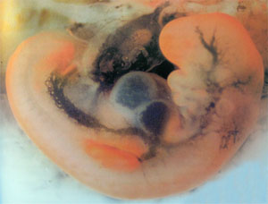 эмбрион 5 недель беременности, фото эмбриона