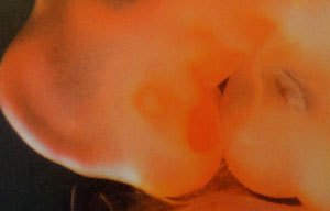 эмбрион, фото эмбриона, 6 неделя беременности, положение носа